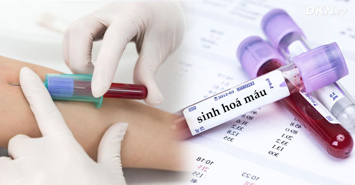 Sàng lọc sinh hóa máu chẩn đoán bệnh gì? và hướng dẫn đọc kết quả